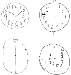clock-drawing-test-dementia